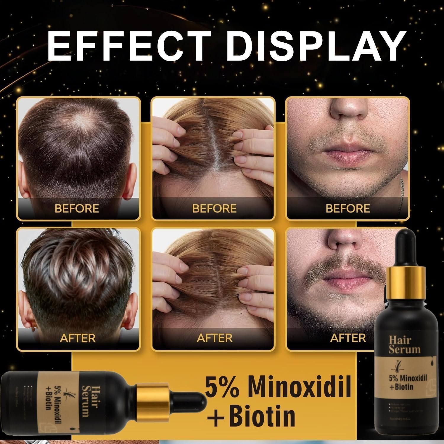 5% Minoxidil + Biotin Hair Serum, Reduces Hair Loss, Nourishes Hair and Scalp, Encourages Hair Growth - Image 5